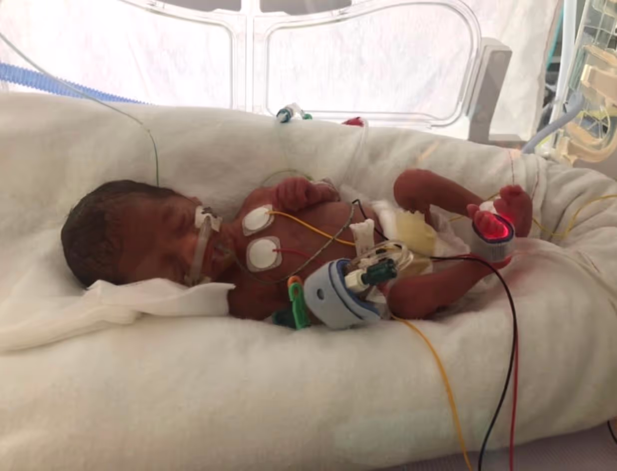 A newborn baby in an incubator